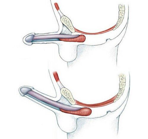 Penis without training pubococcygeus muscle and after