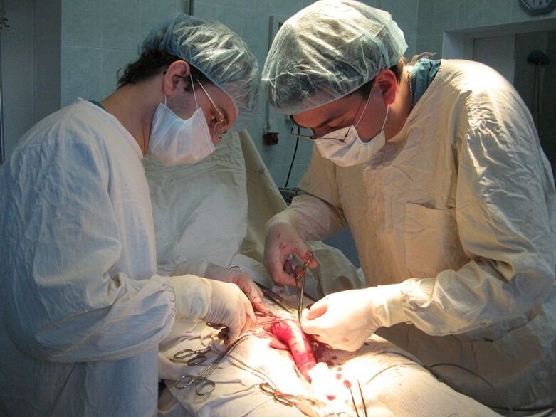 Performing a ligamentotomy – surgery to increase the length of the penis